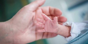 Riski Bebeklerin Takibi ve Fizyoterapi Yaklaşımları